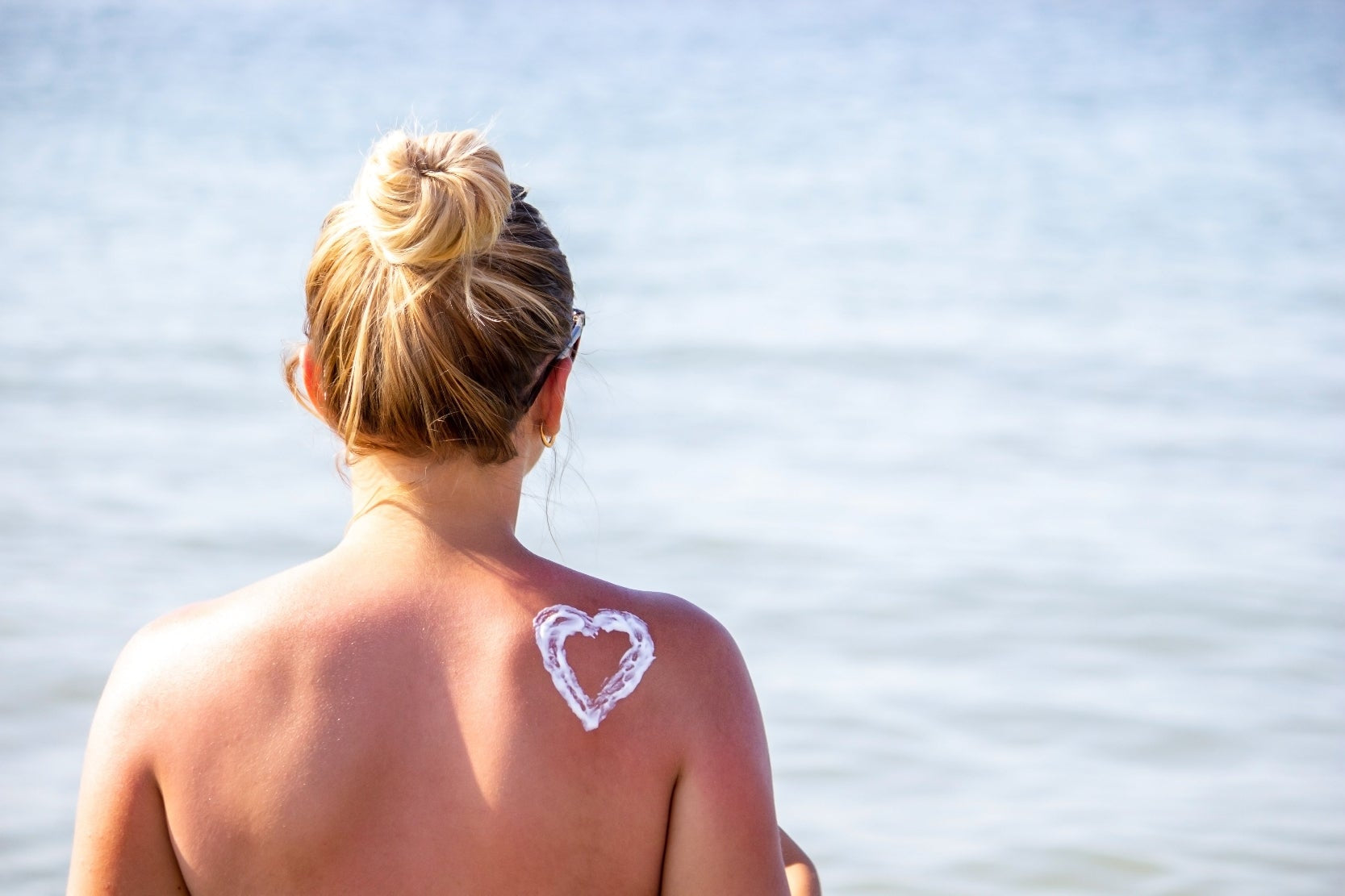 10 Rimedi per le Scottature Solari
