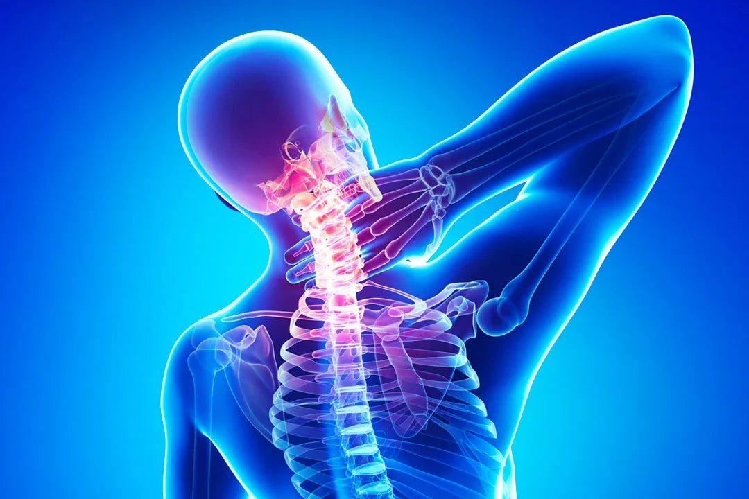 Rimedi per il dolore cervicale: il CBD - Enecta.it